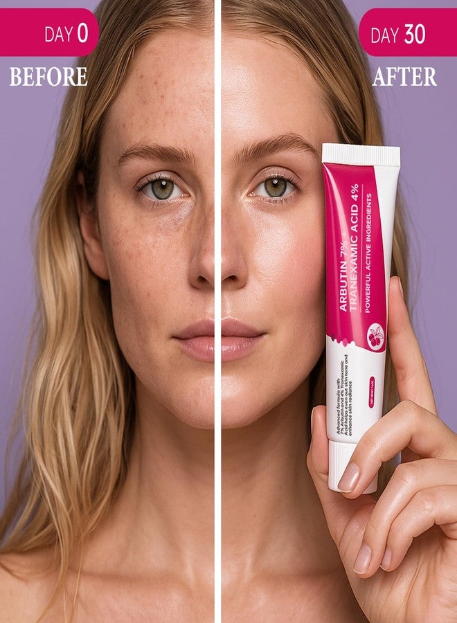 إيلهو عبوتان من كريم أربوتين 7% + حمض الترانيكساميك 4%، بتركيز 70,000 جزء في المليون من الأربوتين و40,000 جزء في المليون من حمض الترانيكساميك، يرطب البشرة وينعمها، ويوحد لونها، ويقلل من البقع الداكنة والتصبغات. - Image 4